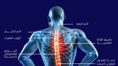 أسرار علاج آلام الظهر
