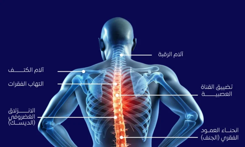 أسرار علاج آلام الظهر