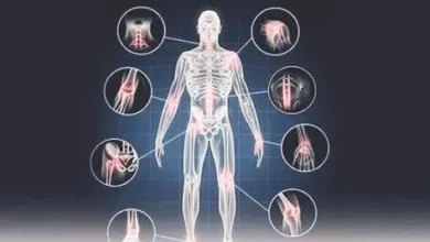 ما هي الفيبروميالجيا