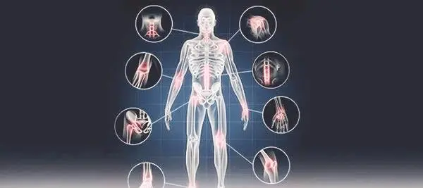 ما هي الفيبروميالجيا