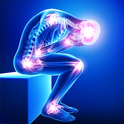 تشخيص الفيبروميالجيا